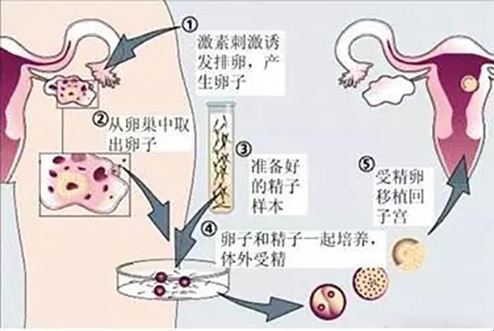 试管婴儿一炮打响，这攻略笑中带泪，槽点满满！