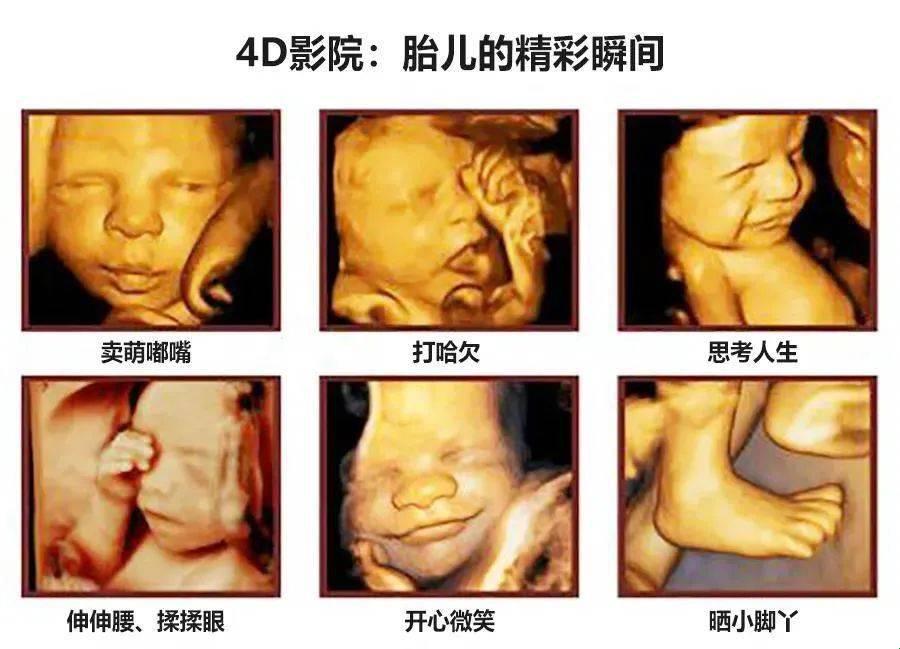 四维彩超探秘：性别谜团，破解有术？