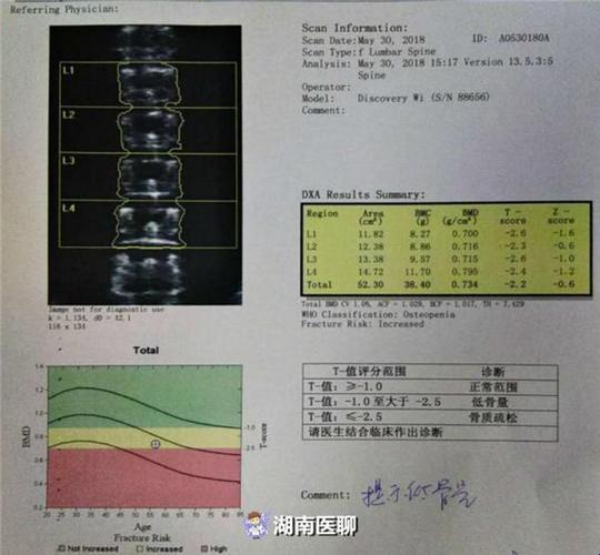 骨密度负五，笑对人生风雨