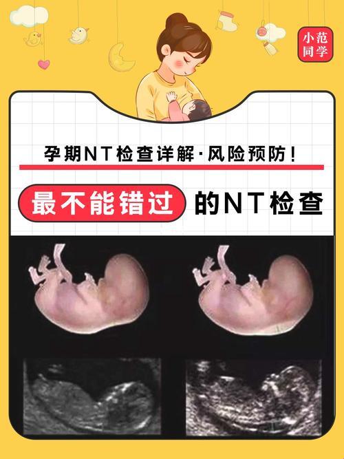 做了NT，还跑去做唐筛？这不是“脱了裤子放屁”么！