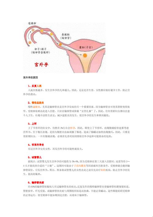 “孕”筹帷幄之外，反应岂止一二