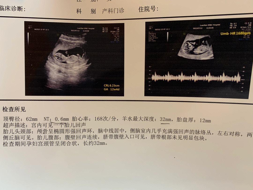 NT初体验：笑谈新手那些破事儿