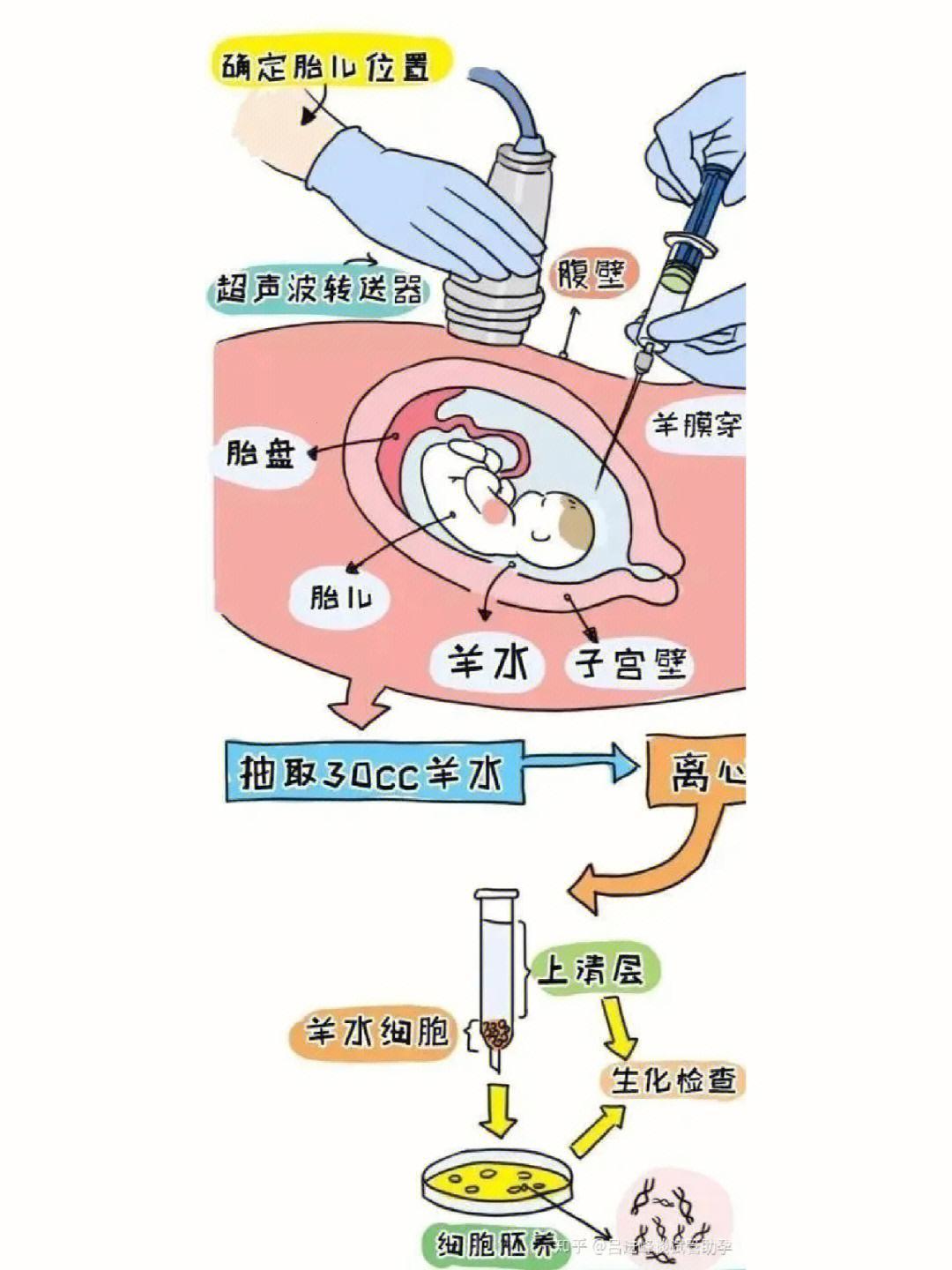 “羊水一把，揭秘生命密码：这‘针’的酷炫你不懂！”