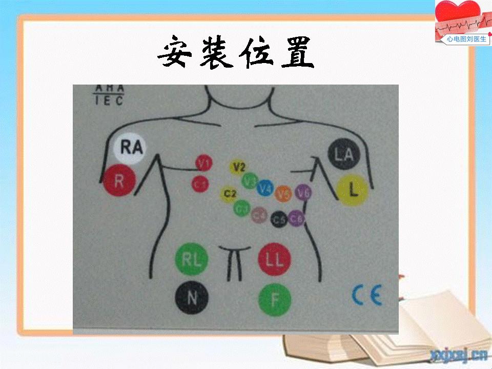 Holter，别戴错了，小心它跟你心有灵犀！