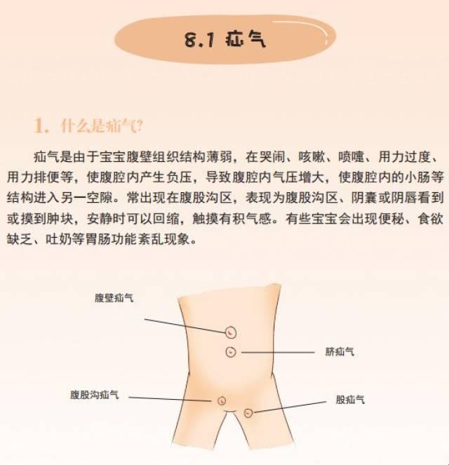 肚皮警报：自查疝气那些趣事儿