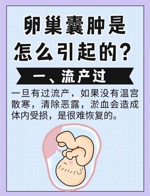 “卵巢囊肿之谜：逗趣探因，妙语连珠”