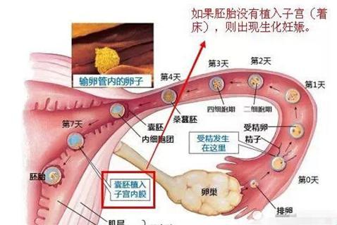 妊娠界的“自然神秘客”：探秘生化妊娠