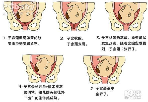 打无痛，难道非得“三指禅”不可？