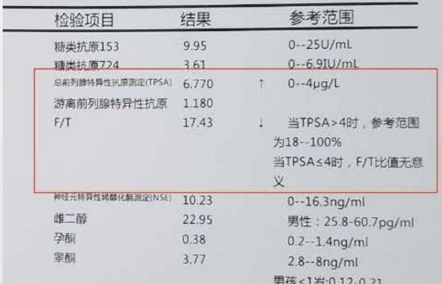 前列腺癌三项指标，惊天动地！