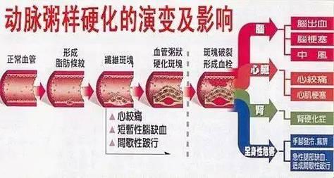 “甲状腺癌”摸老虎尾巴，颈动脉成了“冤大头”？