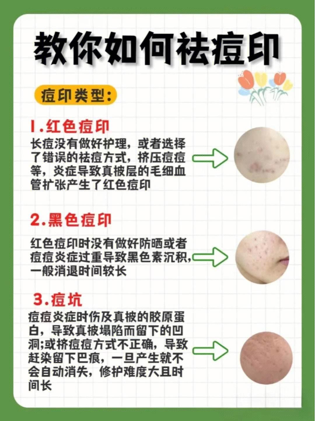 战痘血泪史：鬼畜印迹的终极克星！