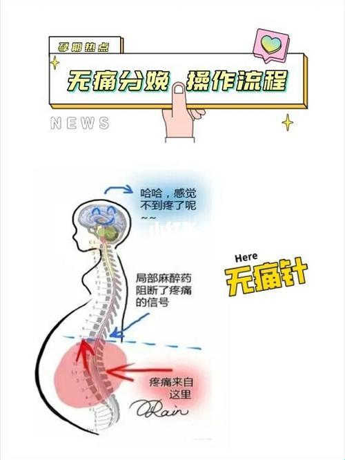 腰椎第几节，无痛分娩的“蜜月”？