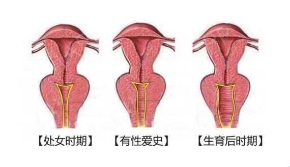 早晨“底肌操”，晚间“云雨情”：揭秘夫妻生活的神秘面纱