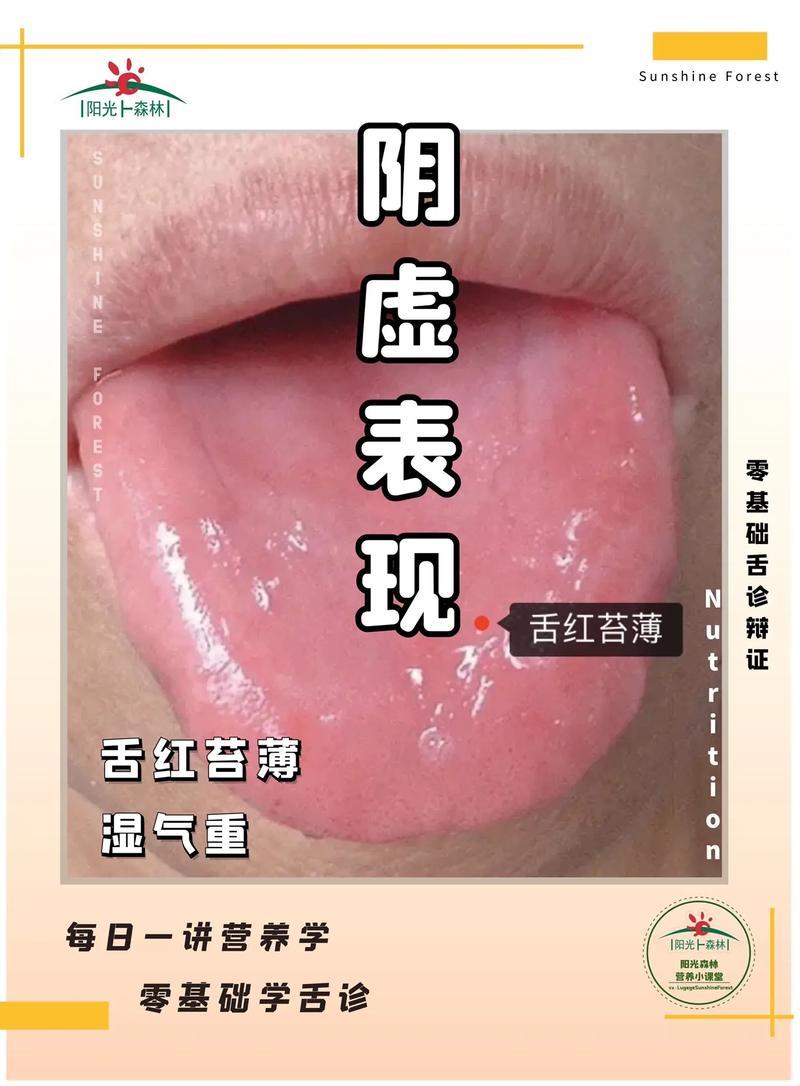 心阴虚的戏法儿：你中了几招？