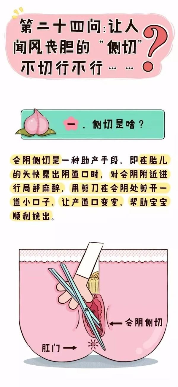 顺产侧切：笑谈女人切肤之痛