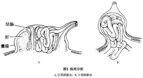 “肚皮外凸，胎儿的身份悬疑：究竟谁是亲爹？”