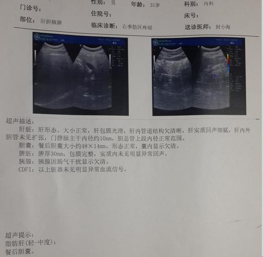 超级误会：医保报销中的幽默与挖苦