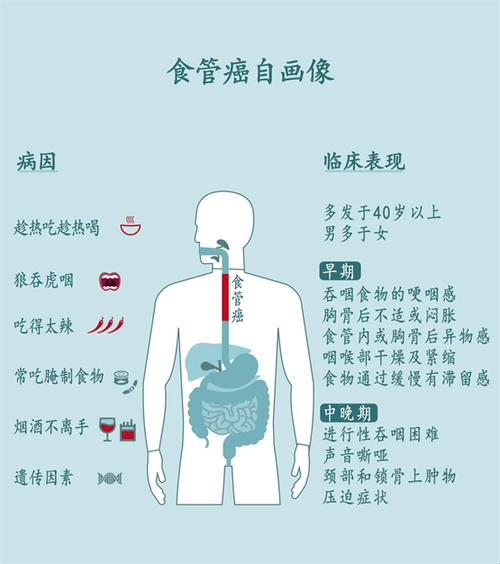 食道癌的前世今生：揭秘那些让人又爱又恨的饮食恶习