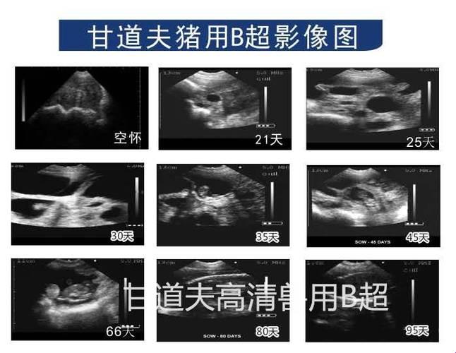 彩超和B超，一“色”之差，还是“视”界不同？