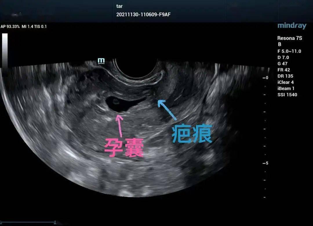 “超”有戏：子宫B超图里的喜剧人生