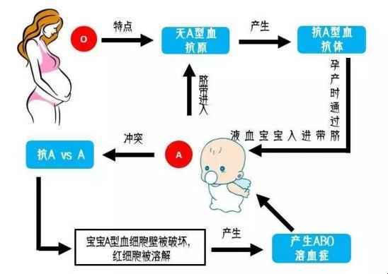 O型妈与B型爸，溶血风险怎么破？