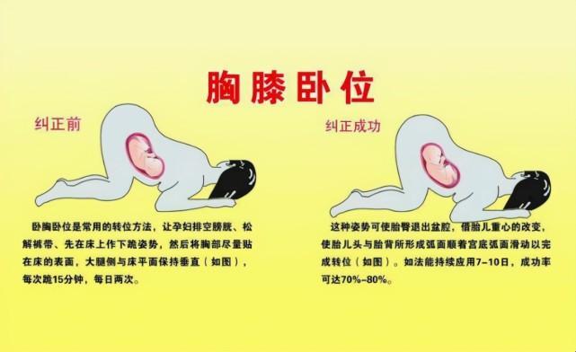 “孕晚期，我是如何‘巧妙’避开胎死腹中的动作”