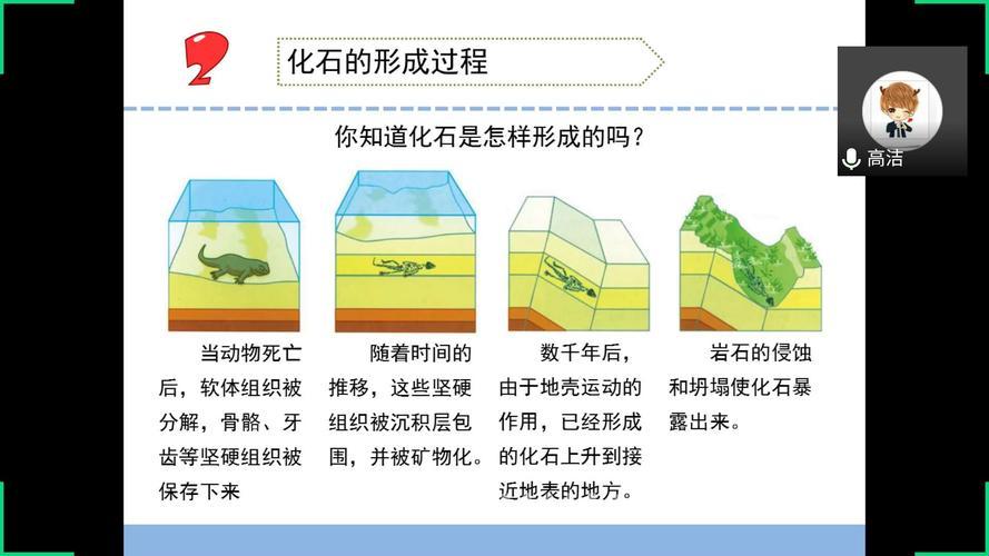 《结石之旅：一块“钻石”的炼成记》