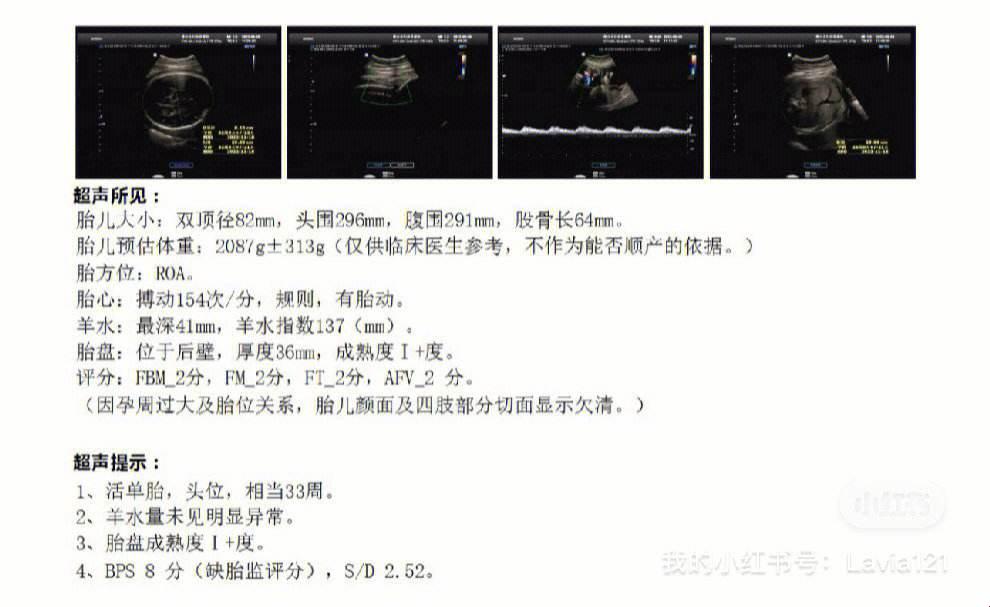 胎盘三级成熟，能熬多久？