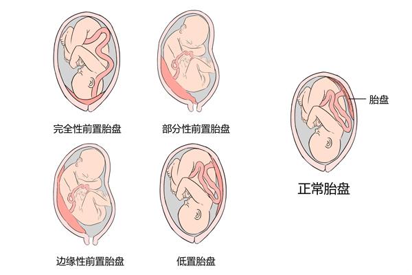 1级胎盘竟如此强悍，续航能力让人瞪目结舌！