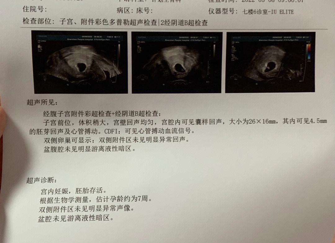 19mm胎芽漫游：受孕几日之谜