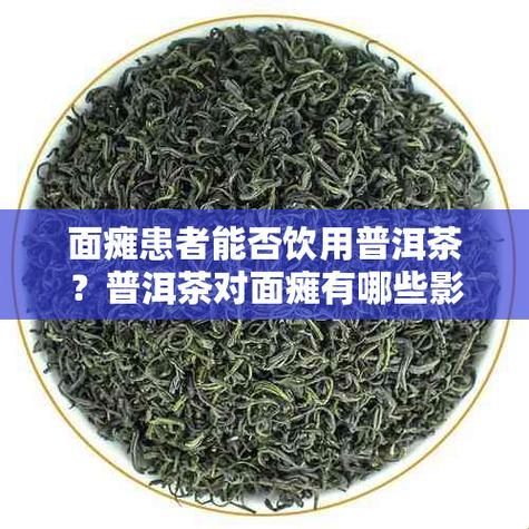 “茶”到病除，面瘫者的“表情包”自救法则