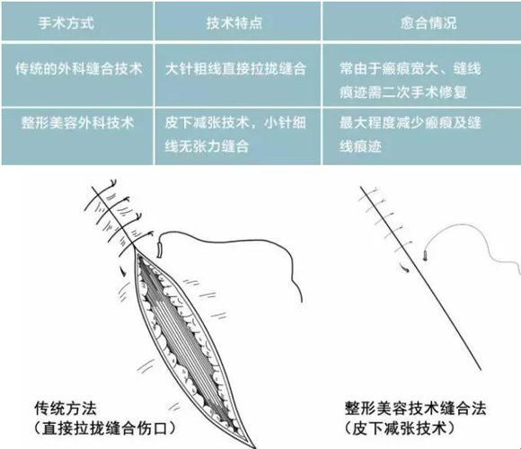 骨折与骨术：笑谈创伤骨科与骨科的诡异分隔