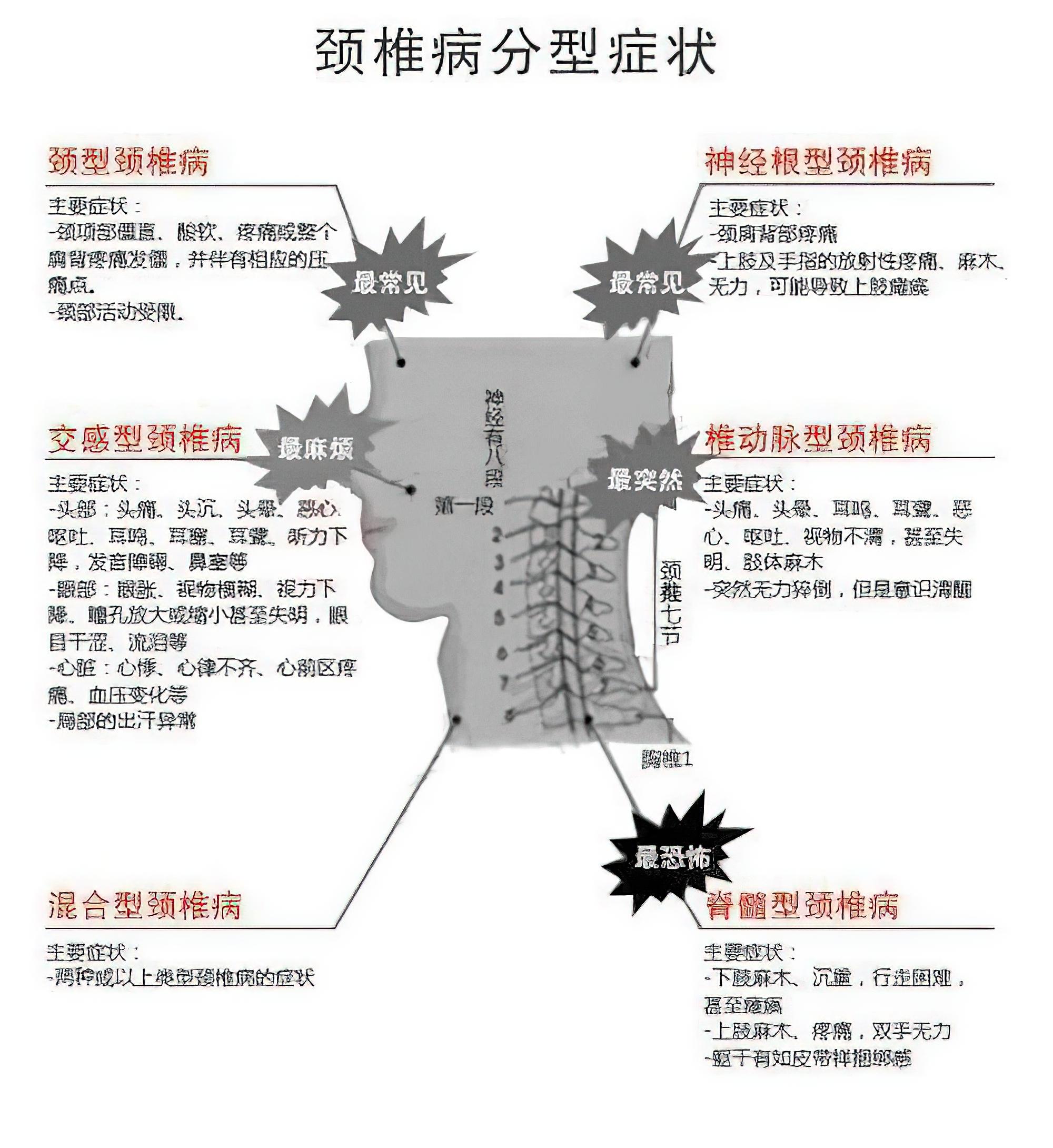 诙谐探秘：中医角度看交感神经型颈椎病