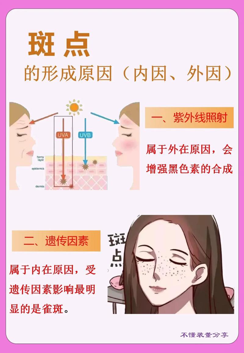 嘿，别让‘黑斑’斑驳了你的心情——探秘它们生成的诡异逻辑