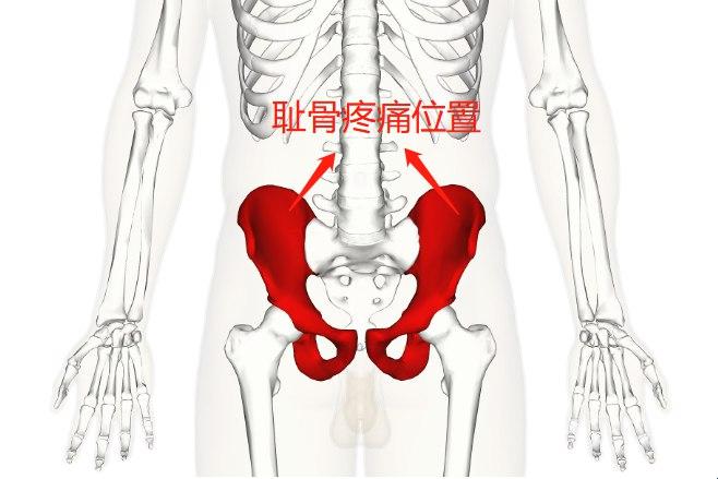 头在耻骨上头，是入盆了吗？