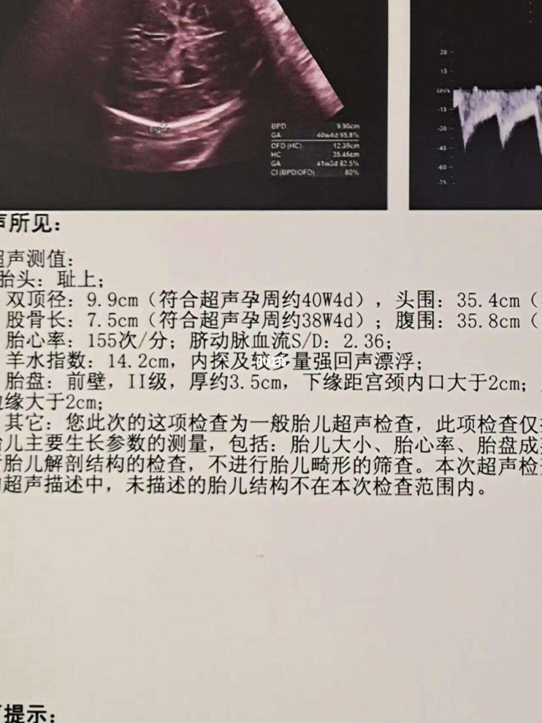 双顶径9.6，顺产or逆天？