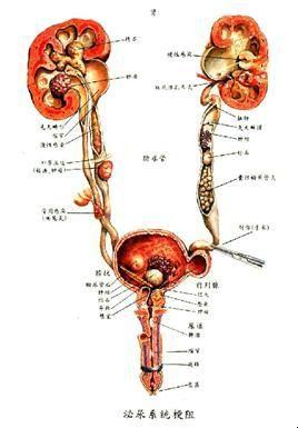 右肾积水，哎哟喂，这事儿闹心不？