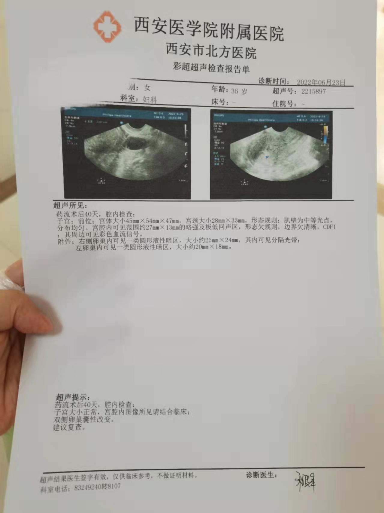 B超，误诊的「神技」？笑谈中透露着几分真理！