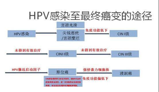 宫颈癌成长记：几年磨一剑？