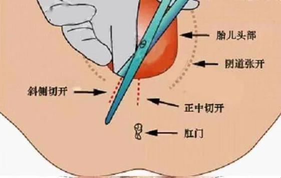 “顺产”中的“中医秘籍”：让你笑到流泪的分娩“奇”谈