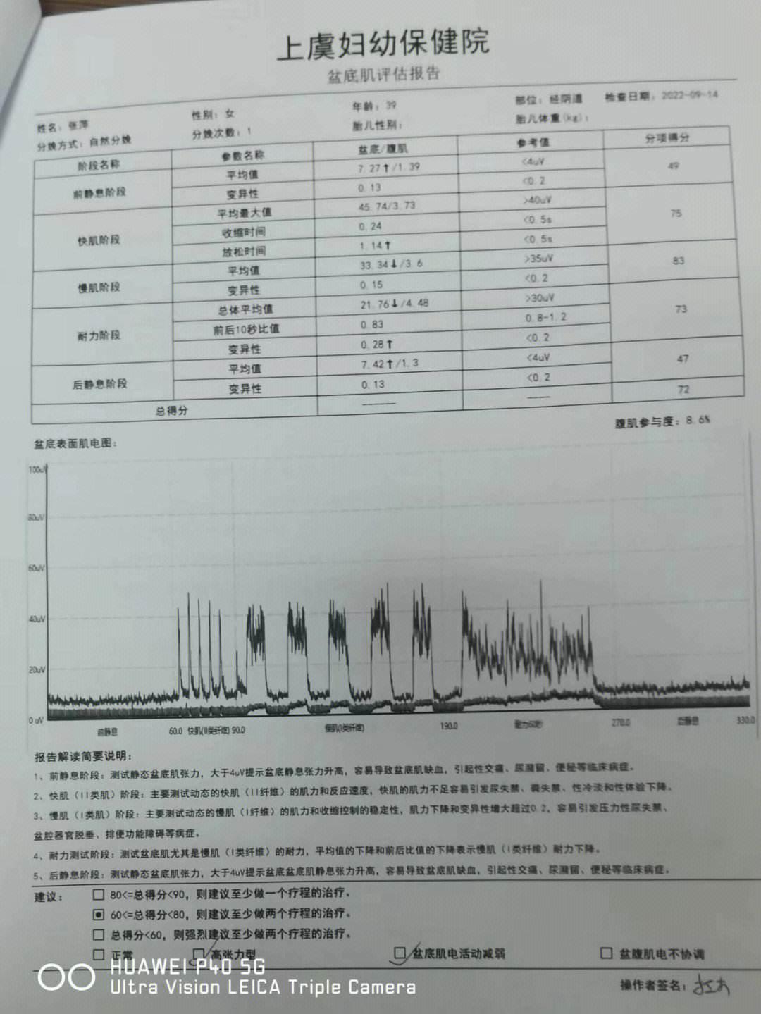 盆底肌检查，阴超的“盛宴”？