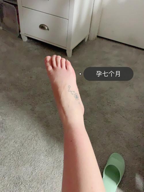 孕妇腿肿，是男孩还是女孩？笑谈“水肿”里的性别秘密