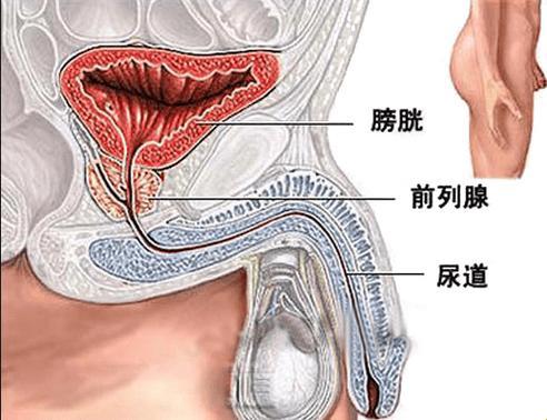 前列腺结石，搞毛啊？笑看生活“小石头”如何翻江倒海