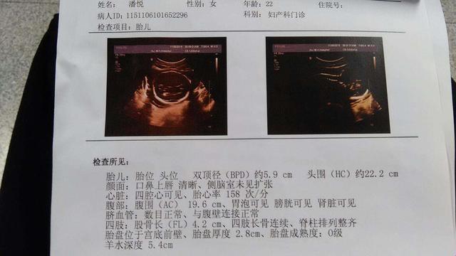教你四维彩超“暗示”性别，惊天秘密大揭秘！