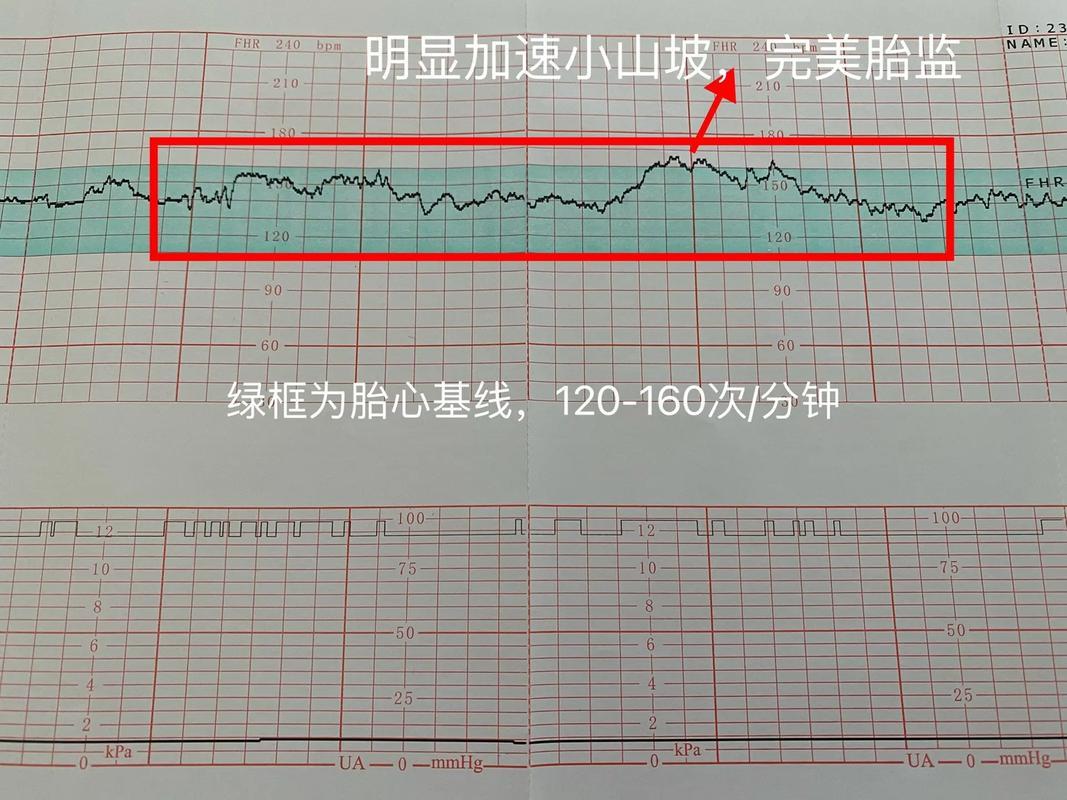 胎心监护？戳心价！医院收费那些事儿