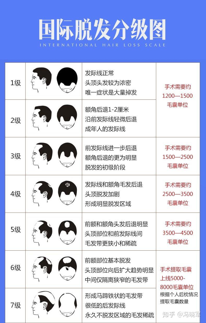 脂溢性脱发，肾阳虚还是肾阴虚？笑谈中破解谜团！