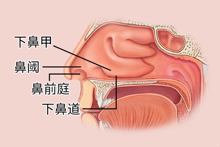 鼻内镜手术多少钱？——一场鼻界的小手术，价目表上的大冒险