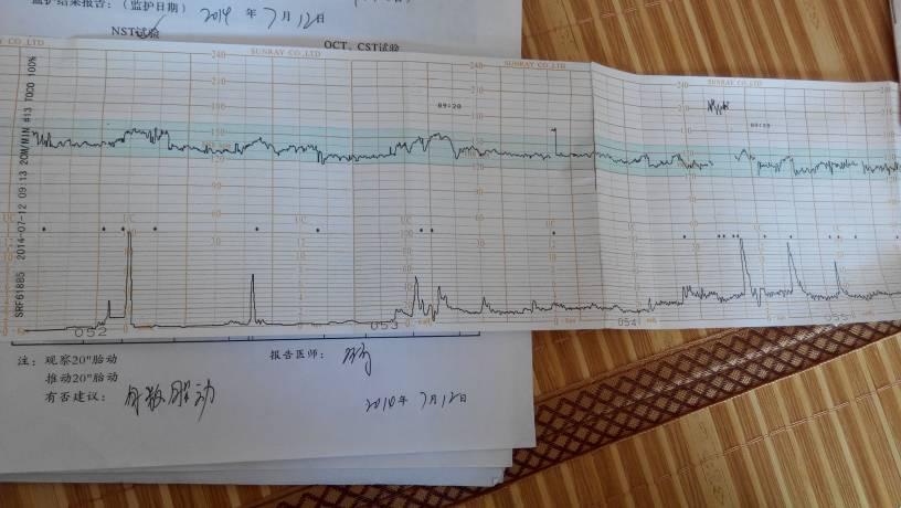 《胎心监护单，揭秘生命跳动的奥秘！》