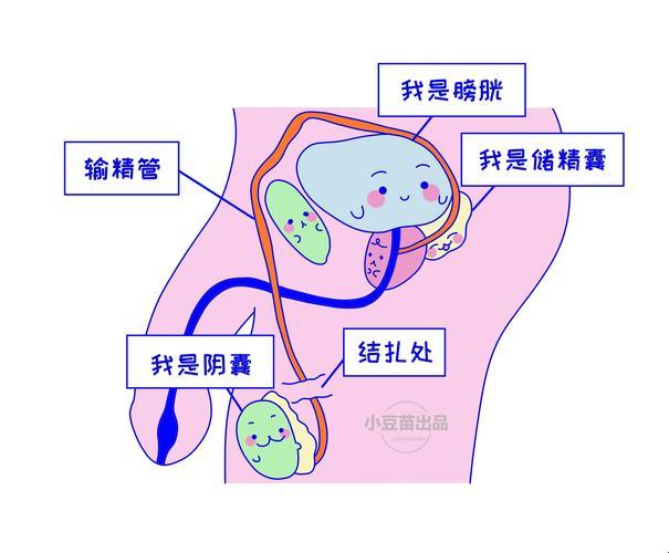 女人结扎，玩的就是心跳？