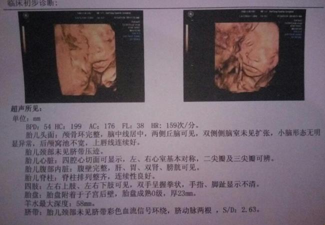 “孕检‘翻盘’奇谭：女子怀女变男，天下大‘逆’”